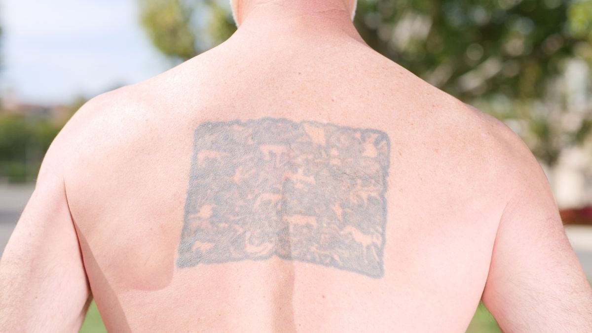 Dos portant un grand tatouage, expose au soleil