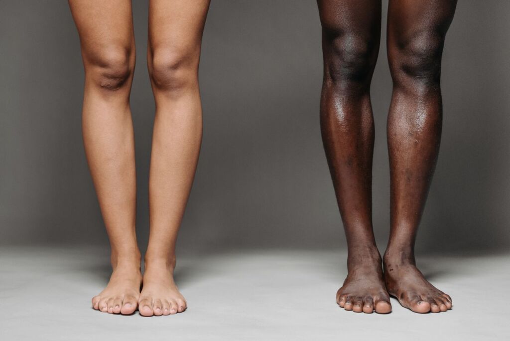 Jambes de deux personnes de phototypes différents côte à côte